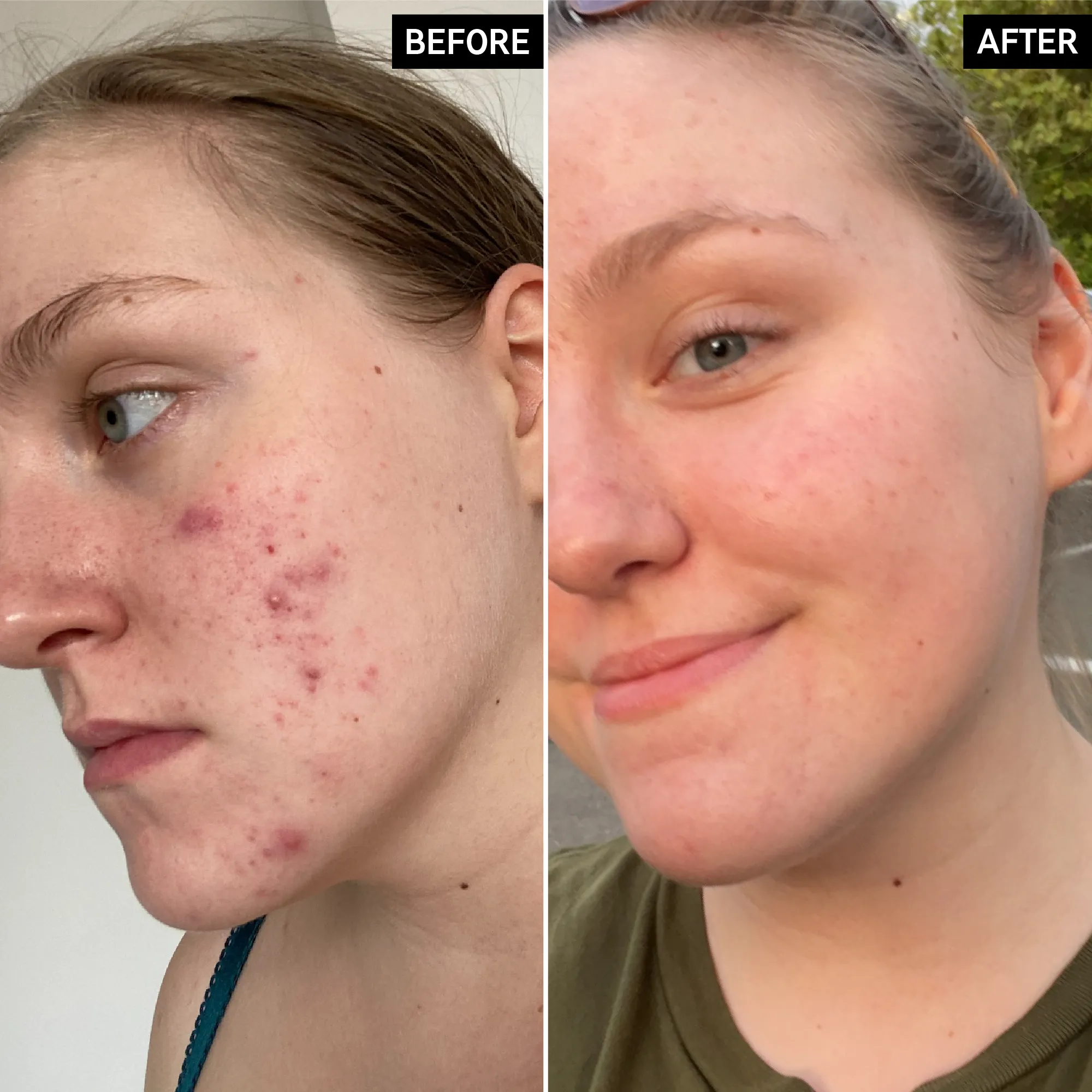 Glycolic Acid Toner